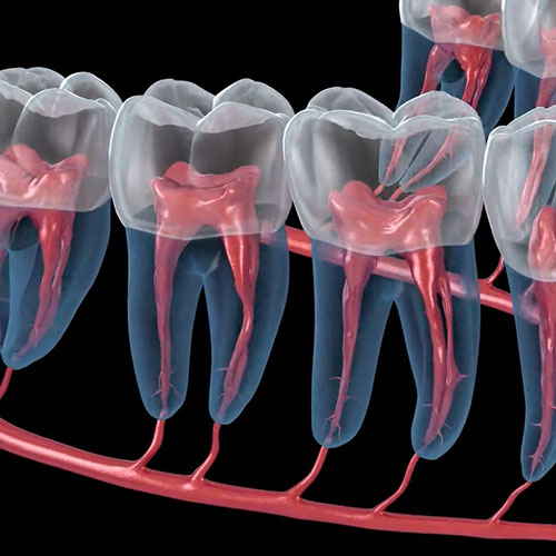 Graphic of nerve respositioning
