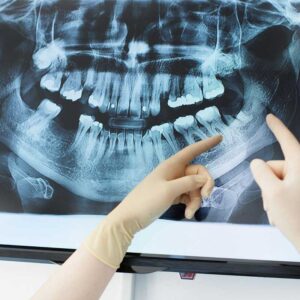 dental xray